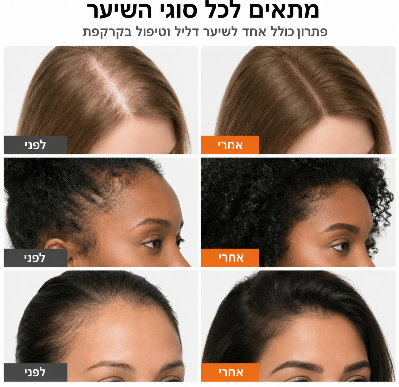 מסרק שמגדל ומחזק את השיער